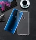 Motorola One Action Hoesje Dun TPU Transparant afbeelding 6